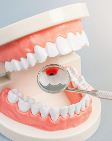 충치 치료